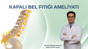 kapalı bel fıtığı ameliyatı ankara