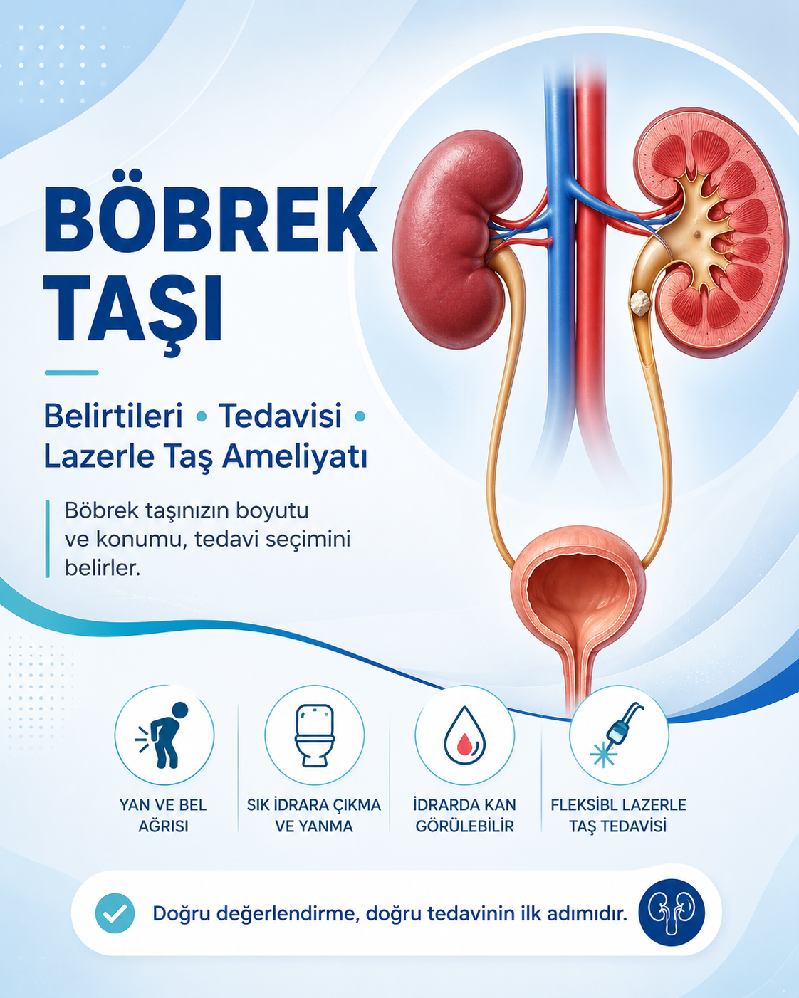 böbrek taşı tedavisi