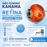 göz içi kanama
